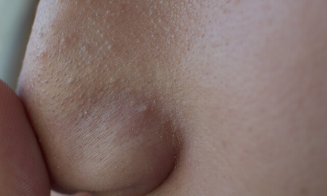 image: Hudormer